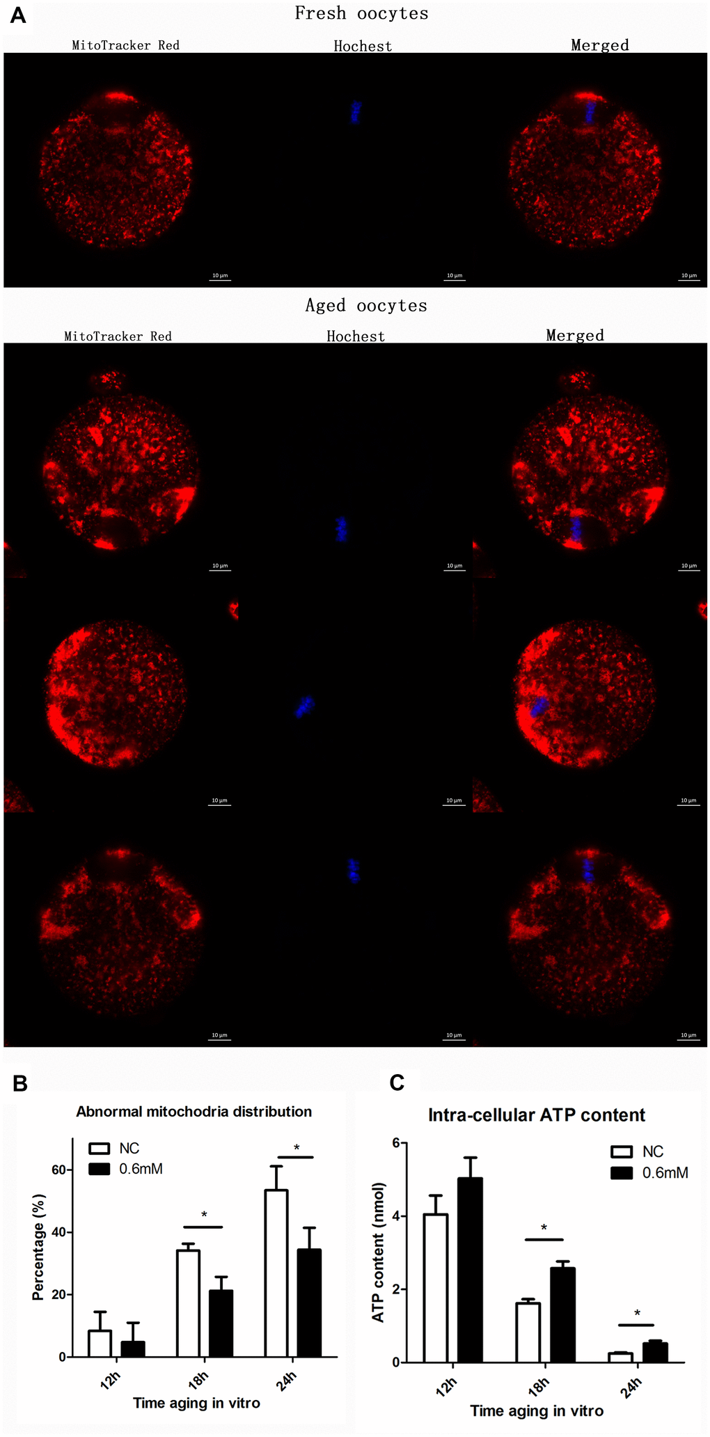 NAC treatment protects the function of mitochondria during post-ovulatory oocyte aging in vitro. (A) Confocal micrographs of mitochondrial distribution. Mitochondria were stained with MitoTracker-Red, and chromosomes were stained with Hoechst 33342 (blue). (B) Percentages of abnormal distribution of mitochondria in oocytes. Oocytes with normal mitochondria distribution and the those with abnormal mitochondira distribution were counted for calculating the percentage of abnormal mitochondria distribution found in oocytes in each experiment. NC, control group in which oocytes were not treated with NAC. 0.6mM, oocytes treated with 0.6mM NAC. Data are expressed as mean ± SEM of at least 3 independent experiments, and 6 superovulated mice were killed to obtain a minimum of 40 oocytes for each experiment. Star represents mean difference, 0.01C) The adenosine triphosphate (ATP) content of mouse oocyte at different aging time points of two groups with or without NAC treatment. A Berthold Lumat LB 9501 luminometer and a commercial assay kit were used for ATP measurement. Six superovulated mice were killed to obtain a minimum of 40 oocytes to investigate the mitochondria distribution for each independent replicates, and 14 superovulated mice were killed to obtain a minimum of 100 oocytes to analyze the ATP content for each independent replicate.