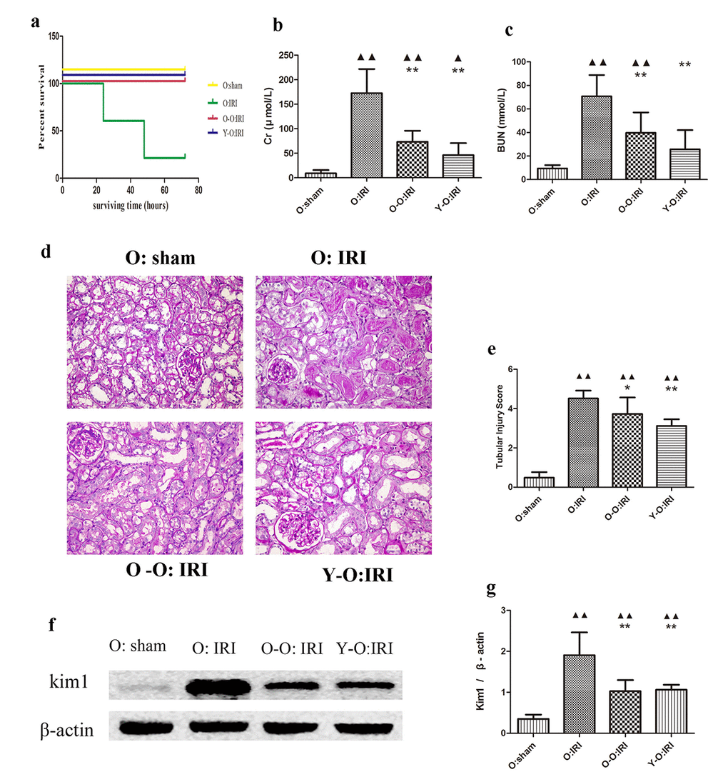 Exogenous biological renal support improved renal IRI and decreased mortality and serum Cr, BUN levels in old IRI mice. (A) Survival curves for the old IRI mice at 72 hours. (B) Cr levels in the old mice. (C) BUN levels in the old mice. (D) Representative photographs of kidney sections from the old mice stained with periodic acid–Schiff (400× magnification). (E) Renal tubular injury score. (F) The levels of Kim1 in kidney extracts from the old mice, as measured by western blotting. Gels were performed under the same experimental conditions. (G) Quantitative analyses of the band densities of Kim1 expression. Values are presented as means ± SDs. ▲P P P P 