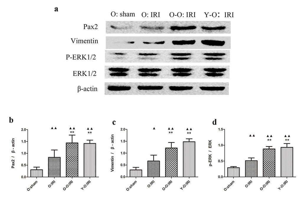 Exogenous biological renal support increased dedifferentiation in old IRI mice kidney. (A) The levels of Pax2, vimentin, and ERK1/2 in kidney extracts of the old IRI mice as measured by western blotting. Gels were performed under the same experimental conditions. (B–D) Quantitative analyses of the band densities of Pax2, vimentin, and ERK1/2 expressions. Data are presented as means ± SDs. ▲P P 