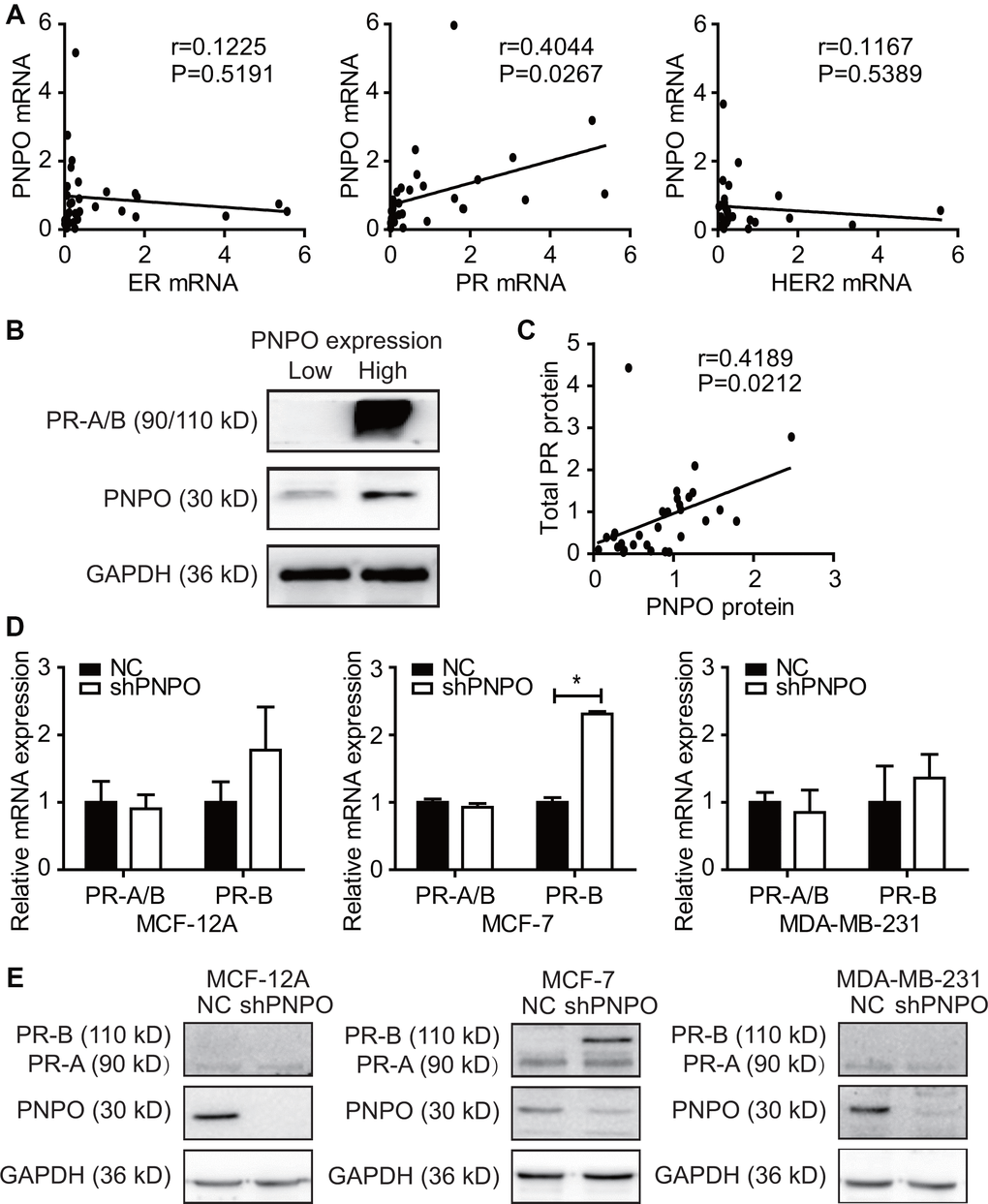 Correlation of PNPO expression with progesterone receptor (PR) expression. (A) Detection of the correlation of PNPO mRNA expression with the expression of ER, PR and HER2 mRNA in breast IDC tissues by qRT-PCR (n = 30 each). (B) Expression of PR and PNPO proteins in IDC tissues of two patients with a low level of PNPO (left sample) and the high level of PNPO (right sample) detected by Western blot. (C) Correlation of PNPO protein expression with PR protein expression in IDC tissues (n =30). (D) Effect of PNPO knockdown by shRNA on PR mRNA expression detected by qRT-PCR. Breast non-cancerous cells (MCF-12A) and cancerous cells (MCF-7 and MDA-MB-231) were treated with PNPO-shRNA (shPNPO) and its negative control (NC). A total PR (PR-A/B) and a B-type PR (PR-B) were detected by qRT-PCR (n = 3). * P E) Effect of PNPO knockdown by shRNA on PR protein expression detected by Western blot in MCF-12A, MCF-7, and MDA-MB-231 cells.