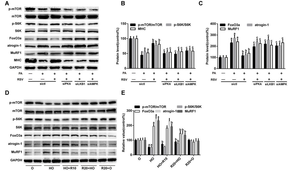 RSV improves protein metabolism via the PKA/LKB1/AMPK signaling pathway. (A) Representative images of the western blotting results for p-mTOR, mTOR, p-S6K, S6K, FoxO3a, atrogin-1, MuRF1 and MHC in L6 myotubes; GAPDH was used as a loading control. (B and C) The bar graphs show quantification of the indicated proteins. Data are expressed as the mean ± SD. aP bP cP D) Representative images of the western blotting results for p-mTOR, mTOR, p-S6K, S6K, FoxO3a, atrogin-1 and MuRF1 in the GAS muscles; GAPDH was used as a loading control. (E) The bar charts show the relative protein levels. Data are expressed as the mean ± SD. aP bP 