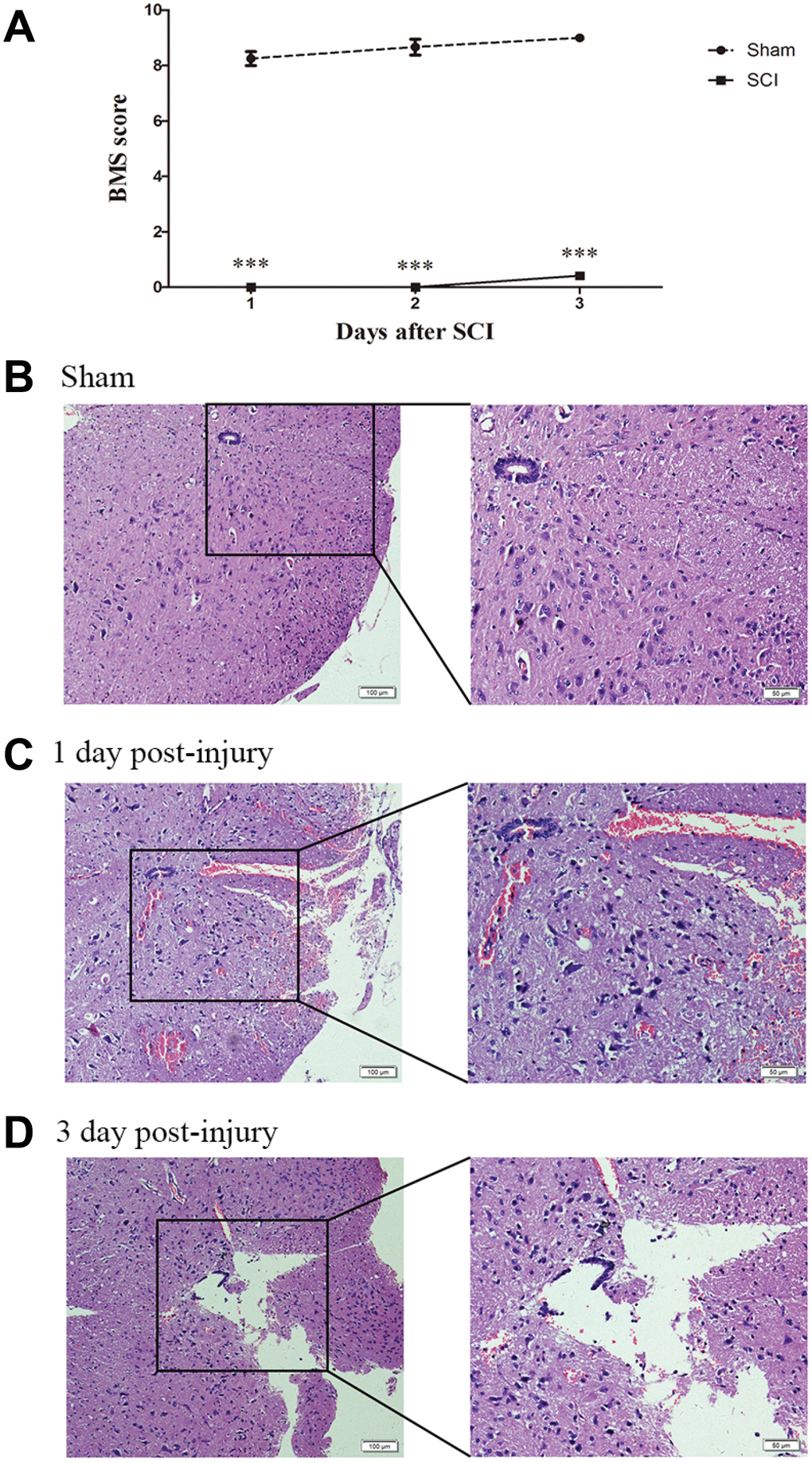 Establishment of SCI animal model. (A) BMS scores indicate the motor functional index 3 days after SCI. ***PB–D) H&E staining of spinal cord samples from the sham and SCI groups at days 1 and 3 postsurgery.