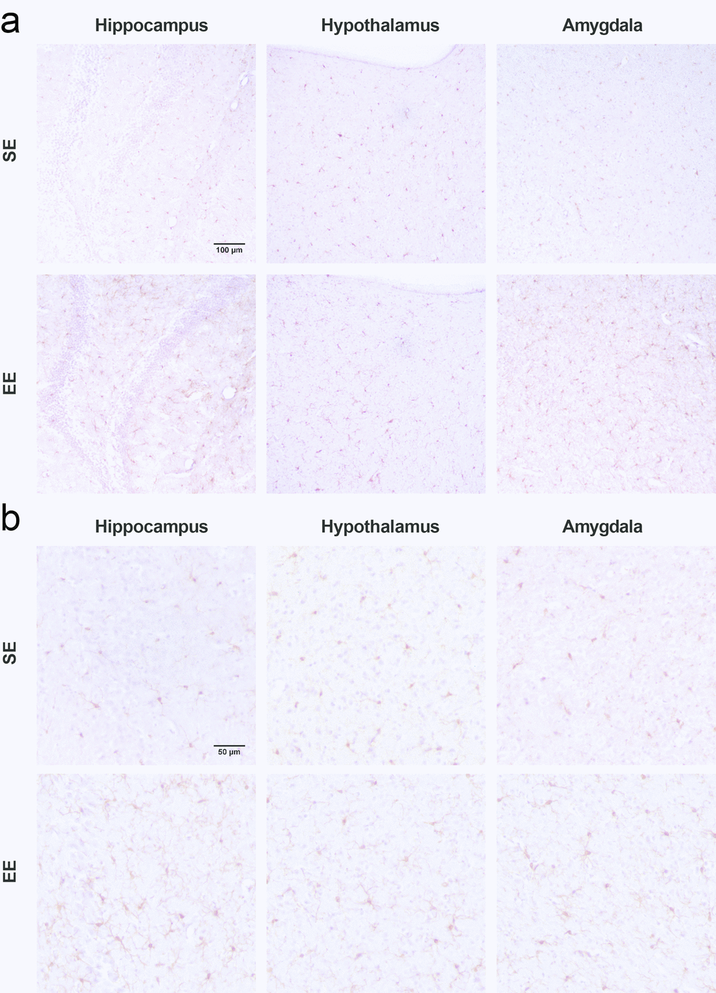 Microglial changes observed after 7.5-month EE. (a) Representative fields of Iba1 stained IHC in the hippocampus (left), hypothalamus (middle), and amygdala (right) at 20x magnification. (b) 40x magnification. Scalebars, (a) 100 µm and (b) 50 µm.