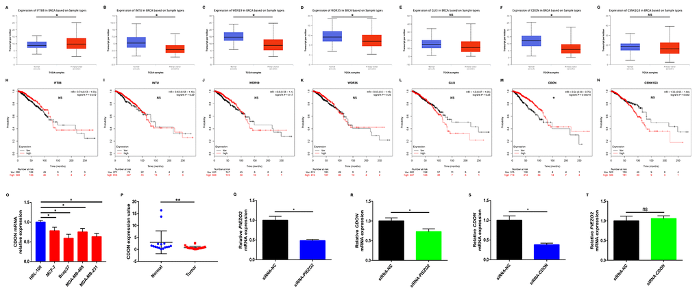 Identification of potential downstream of PIEZO2 in breast cancer. (A-G) Expression of IFT88, INTU, WDR19, WDR35, GLI3, CDON and CSNK1G3 in breast cancer analyzed using UALCAN; (H-N) prognostic roles of IFT88, INTU, WDR19, WDR35, GLI3, CDON and CSNK1G3 in breast cancer analyzed using Kaplan Meier-Plotter; (O) CDON expression in human breast cancer cell lines (MCF-7, Bcap37, MDA-MB-468 and MDA-MB-231) compared with that in normal breast cell line (HBL-100); (P) CDON expression in clinical breast cancer tissues compared with that in matched adjacent normal tissues (n=16); (Q) knockdown effect of siRNA-PIEZO2 in MCF-7 cell line; (R) expression change of CDON after silencing expression of PIEZO2 in MCF-7 cell line; (S) knockdown effect of siRNA-CDON in MCF-7 cell line; (T) expression change of PIEZO2 after silencing expression of CDON in MCF-7 cell line. *P