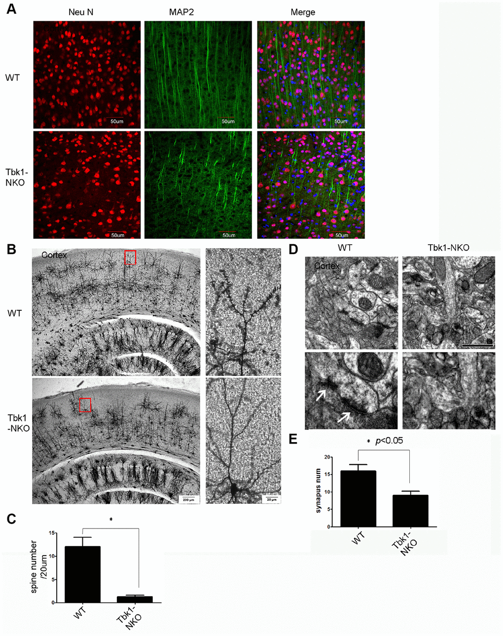 Dendro-synaptic alterations induced by Tkb1 deficiency. (A) NF and MAP2 immunofluorescence was used to visualize dendrites. (B) Golgi-Cox brain staining in Tbk1-NKO and WT mice (n = 3). (C) Analysis of dendritic spine density (n = 10). *P D–E) Cortical synapse numbers, quantified from electron microscopy images (n = 6-7). *P 