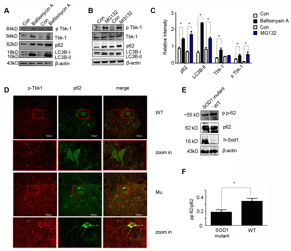 In vitro and in vivo protein expression analyses. (A–C) Western blot analysis of p-Tbk1, total Tbk1, LC3B-II, and p62 in NSC-34 cells treated with bafilomycin A, MG132, or solvent control (Con) (n = 3); *P D) Double immunofluorescence of p-Tbk1 and p62 in the lumbar spinal cord of SOD1G93A mice and WT littermates. Bar = 100 μm. (E–F) Western blot analysis of p62 phosphorylation status in SOD1 mutant mice and WT controls (n = 3); *P 