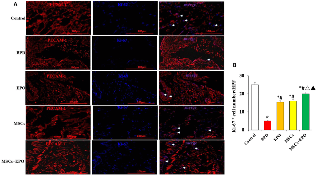 Immunofluorescence analysis of the proliferative activity of microvascular endothelium in vivo. (A) Ki-67 (blue) and PECAM-1 (red) double staining using a light microscope at ×400 magnification. (B) Comparative analysis of the OD value in each group. Data are presented as the mean ± SD. *P #P △P▲P
