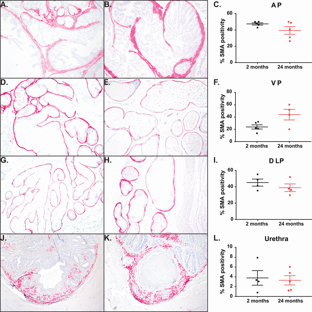 Aging has no impact on percentage of smooth muscle cells. (A) Representative image of smooth muscle α-actin (SMA) staining within the AP in young mice. (B) Representative image SMA staining within the AP in aged mice. (C) Quantitation of percent SMA within the AP shows no difference with age. (D) Representative image of SMA staining within the VP in young mice. (E) Representative image SMA staining within the VP in aged mice. (F) Quantitation of percent SMA within the VP shows no difference with age. (G) Representative image of SMA staining within the DLP in young mice. (H) Representative image SMA staining within the DLP in aged mice. (I) Quantitation of percent SMA within the DLP shows no difference with age. (J) Representative image of SMA staining within the prostatic urethra of young mice. (K) Representative image SMA staining within the prostatic urethra of aged mice. (L) Quantitation of percent SMA around the urethral lumen within the prostatic urethra shows no difference with age.