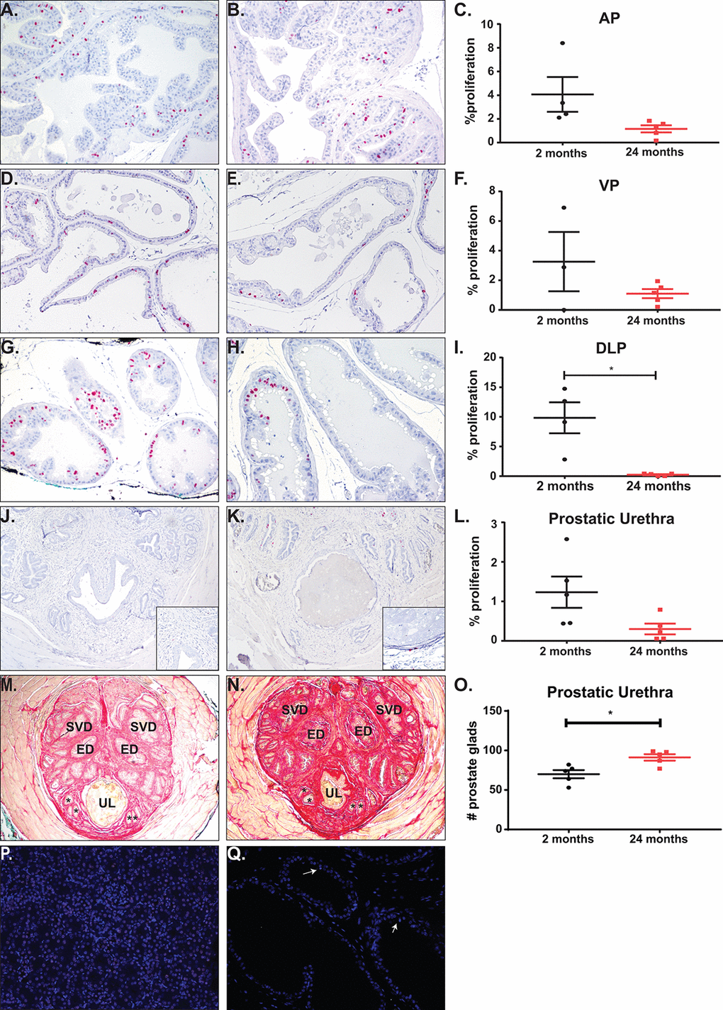 Total proliferation increases with age with no change in proliferation or apoptosis rates. (A) Representative image of BrdU accumulation within the AP of young mice. (B) Representative image of BrdU accumulation with the AP of aged mice. (C) Quantitation of percent proliferation within the AP shows no significant change in proliferation rate with age. (D) Representative image of BrdU accumulation within the VP of young mice. (E) Representative image of BrdU accumulation with the VP of aged mice. (F) Quantitation of percent proliferation within the VP shows no significant change in proliferation rate with age. (G) Representative image of BrdU accumulation within the DLP of young mice. (H) Representative image of BrdU accumulation with the DLP of aged mice. (I) Quantitation of percent proliferation within the DLP shows a significant decrease in proliferation rate with age. (J) Representative image of BrdU accumulation around the urethral lumen within the prostatic urethra of young mice. Inset (K) Representative image of BrdU accumulation around the urethral lumen within the prostatic urethra of aged mice. (L) Quantitation of percent proliferation around the urethral lumen within the prostatic urethra shows no significant change in proliferation rate with age. (M) Representative image of the prostatic urethra of young mice. * denote representative prostate glands within the rhabdosphincter. (N) Representative image of the prostatic urethra of young mice. *, prostate glands; ED, ejaculatory duct; SVD, seminal vesicle duct; UL, urethral lumen. (O) Quantitation of prostate glands within the prostatic urethra shows a significant increase in gland number with age. (P) Staining for apoptosis of a kidney section with induced DNA breaks shows a significant percentage of TUNEL positive cells (green). (Q) Representative image of apoptosis in prostate tissue shows little to no TUNEL positive cells (white arrows).