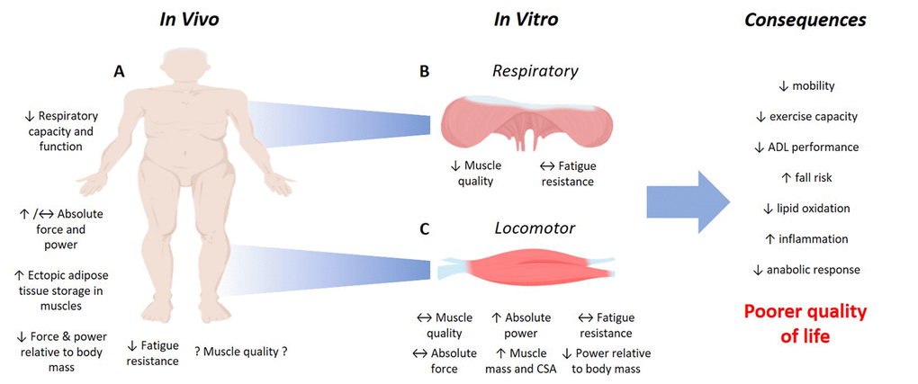 Impact of obesity in old age on skeletal muscle function. Excessive adiposity in old age causes a significant reduction in contractile performance in humans (A). Less is known about how obesity in old age affects muscle quality (force or power relative to muscle mass), so usage of an isolated muscle model can provide information about the contractile performance of isolated respiratory (B) and locomotor (C) skeletal muscles, otherwise difficult to examine in vivo (observations from Hill et al., 2019). Whilst the studies of in vivo and in vitro muscle performance do not reciprocate one another, the overall consequence of the altered contractile performance of old obese skeletal muscles is a poorer quality of life. ADL, Activities of daily living. Images from BioRender.