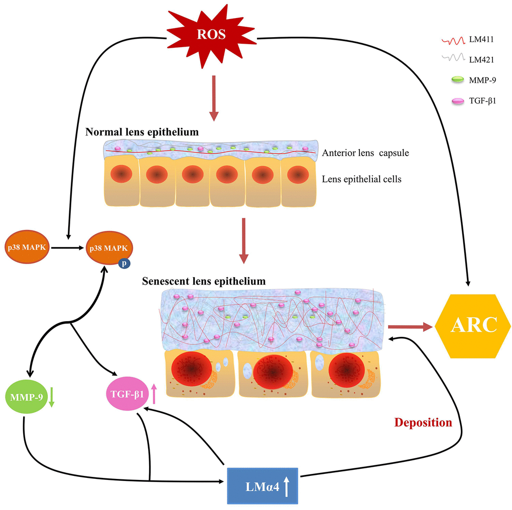 Summary of anterior lens capsular proteins and possible regulatory mechanism in age-related cataract (ARC). Schematic diagram of reactive oxygen species related senescent lens epithelial cells and senescent anterior lens capsules along with up-regulation of total LM, LMα4 and TGF-β1 and down-regulation of MMP-9.