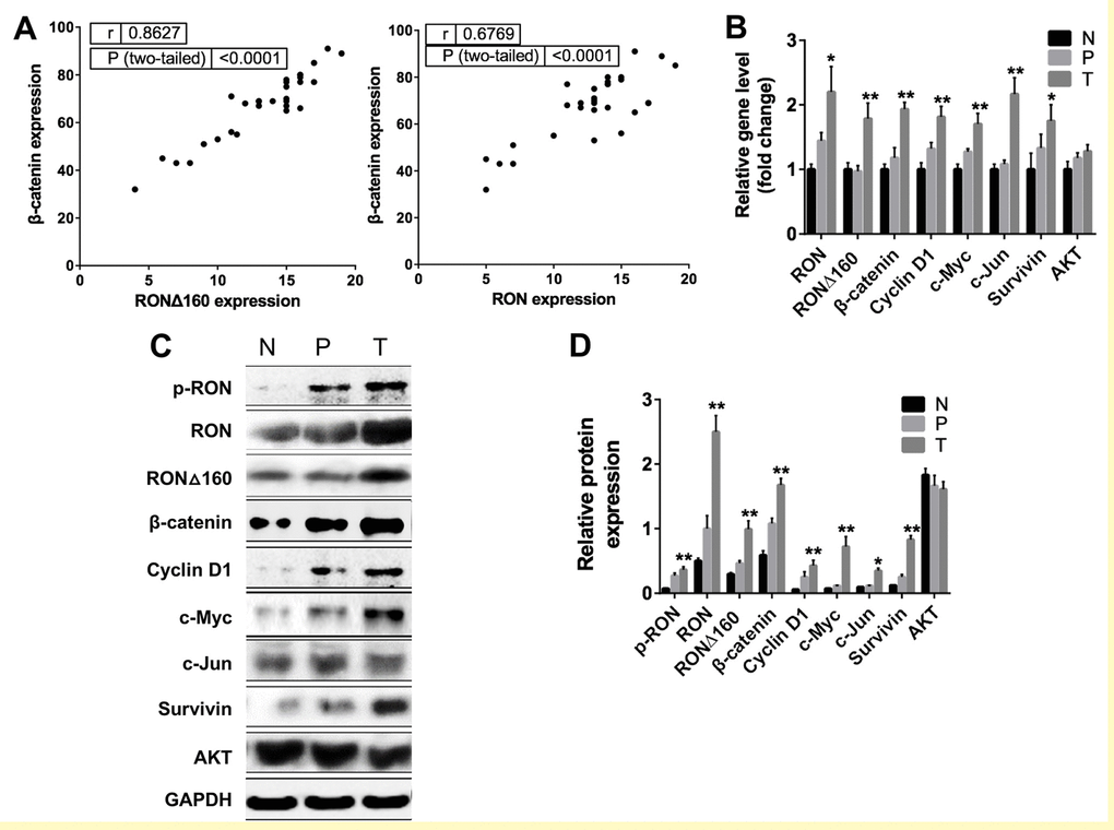 Correlation between RON and β-catenin in primary human gastric cancer tissues. (A) Scatter plot showing the correlation between RON/RONΔ160 and β-catenin levels in samples of human gastric cancer, paracancerous tissue and normal gastric tissue. (B) Relative expression of Wnt/β-catenin signaling pathways related genes in T, P and N were detected by qRT-PCR and normalized to GAPDH. (C) Representative Western blotting data of RON and Wnt signaling molecules in T, P and N. (D) Quantification of RON and Wnt signaling proteins in T, P and N. *, p