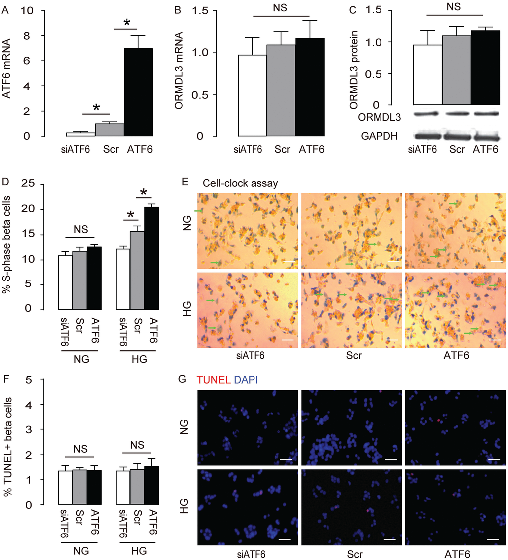 ATF6 increases beta cell proliferation cultured in HG. Min6 cells were kept in high glucose (20mmol/l) culture, and transfected with ATF6, or scrambled (Scr), or siRNA for ATF6 (siATF6). (A–B) RT-qPCR for ATF6 (A) and ORMDL3 (B). (C) Western blot for ORMDL3. (D–E) Cell-clock cell cycle assay, shown by quantification of S-phase cells (D), and by representative images (E). (F–G) TUNEL assay, shown by quantification (F), and by representative images (G). DAPI: nuclear staining. NG: normal glucose culture. HG: high glucose culture. Arrows pointed to S-phase cells. *p