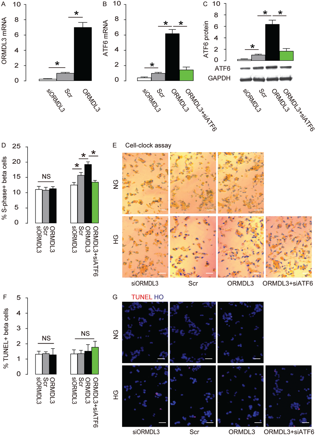 ORMDL3 increases beta cell proliferation cultured in HG through ATF6. Min6 cells were kept in high glucose (20mmol/l) culture, and transfected with ORMDL3, or scrambled (Scr), or siRNA for ORMDL3 (siORMDL3) or ORMDL3 plus siATF6. (A–B) RT-qPCR for ORMDL3 (A) and ATF6 (B). (C) Western blot for ATF6. (D–E) Cell-clock cell cycle assay, shown by quantification of S-phase cells (D), and by representative images (E). (F–G) TUNEL assay, shown by quantification (F), and by representative images (G). DAPI: nuclear staining. NG: normal glucose culture. HG: high glucose culture. *p