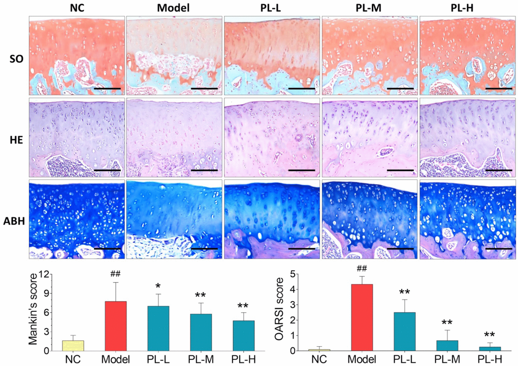 Observation of histopathological stainings (HE, SO, and ABH) with Mankin′s scoring and OARSI scoring of rat joints. Values are shown as mean ± SD. ##P P P 