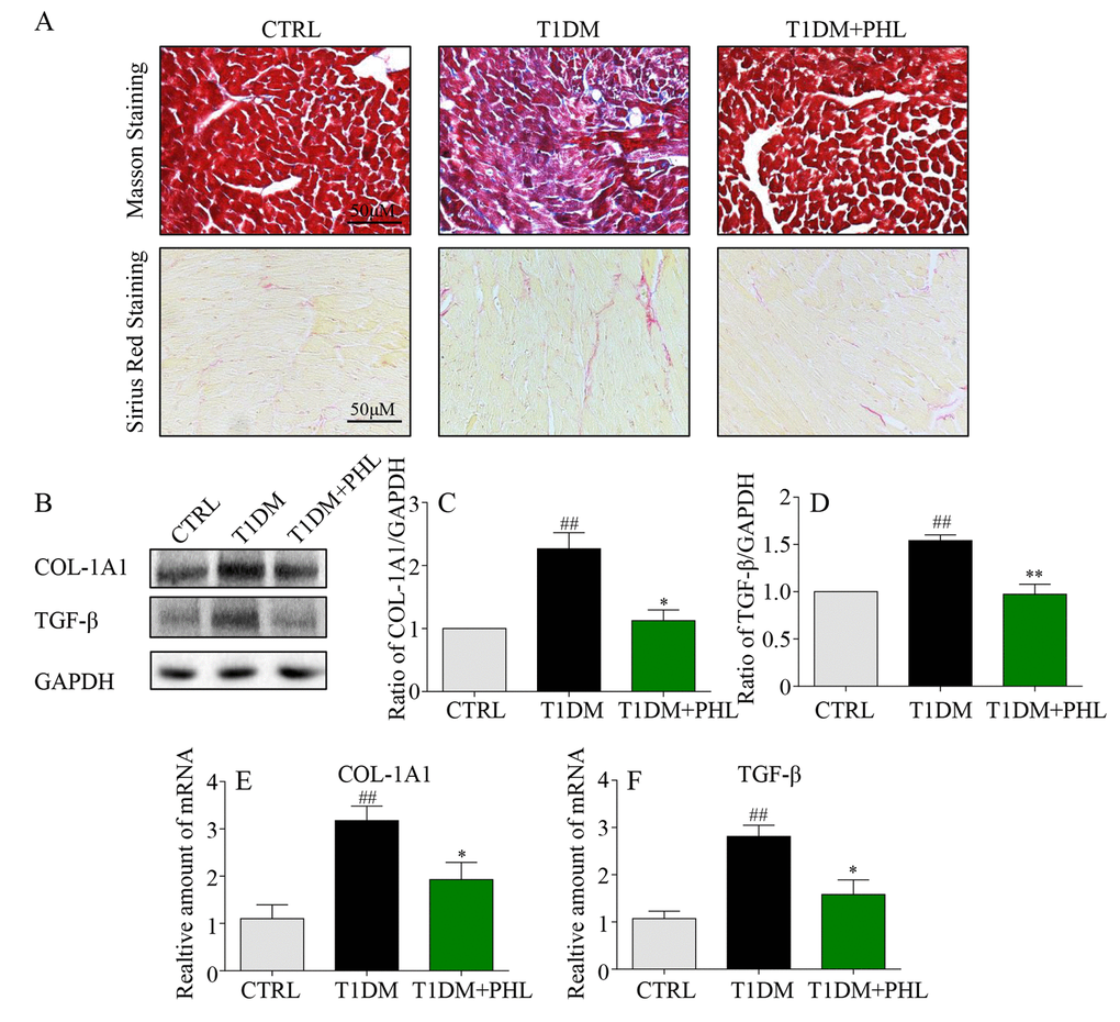 Phloretin reduced hyperglycemia-induced fibrosis in the heart of diabetic mice. (A) Myocardial tissues from each group were subjected to Masson’s Trichrome staining and Sirius red staining assay as described in Methods. (B-C) Western blot analysis for the protein expression of COL-1A1 and TGF-β in the myocardial tissues, with GAPDH as a loading control. (D-F) The mRNA expression levels of COL-1A1 and TGF-β in myocardial tissues of each group were determined by real-time qPCR. More than five mice in each group were used for above analysis. *P #P ##P 