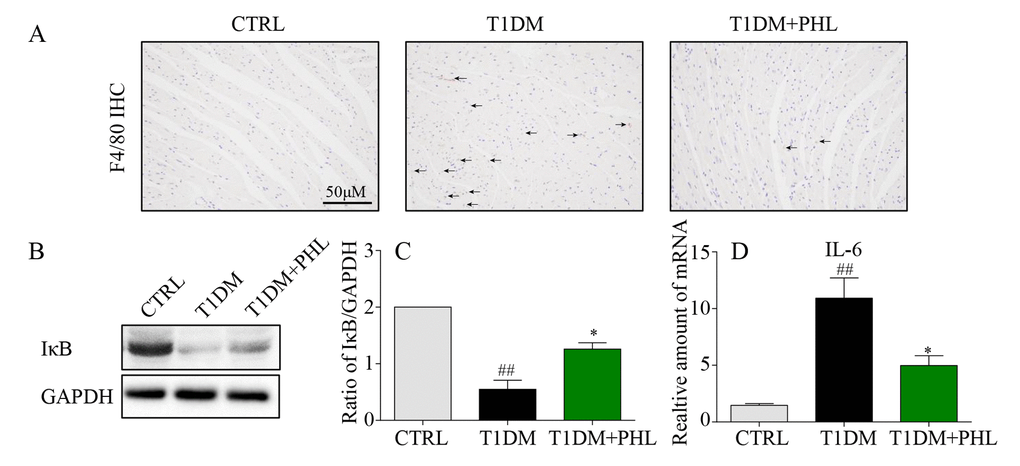 Phloretin reduced hyperglycemia-induced inflammation in the heart of diabetic mice. (A) Heart tissues were subjected to IHC analysis with anti-F4/80 antibodies as described in Methods (400x magnification). (B-C) Western blot analysis for the IκB degradation in the myocardial tissues, with GAPDH as a loading control. (D) The mRNA expression levels of IL-6 in myocardial tissues of each group were determined by real-time qPCR. More than five mice in each group were used for above analysis. *P #P ##P 