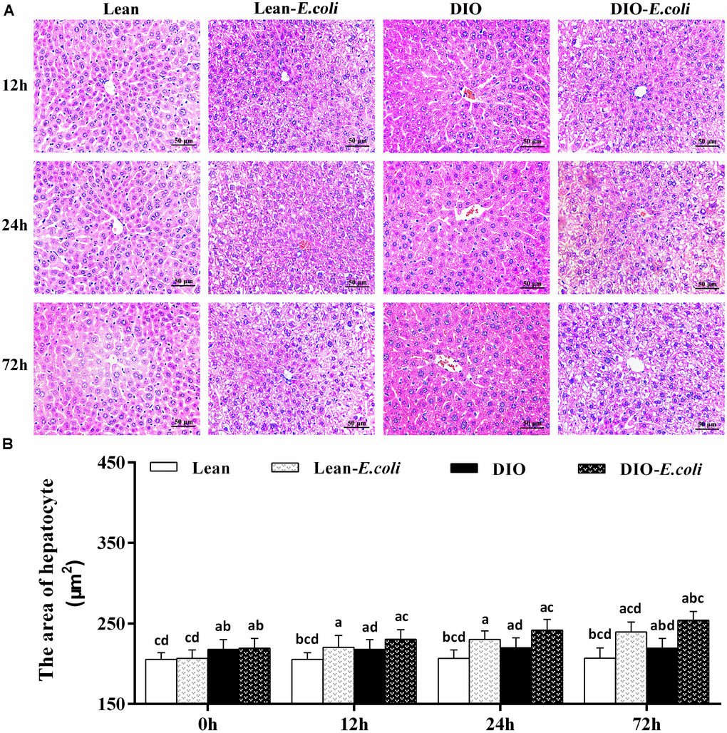 The histopathological changes of the liver after E. coli infection. (A) The representative histopathological images of livers (HE staining, bar=50 μm); (B) The area of hepatocyte. Note: Letter a, b, c or d represent difference (p