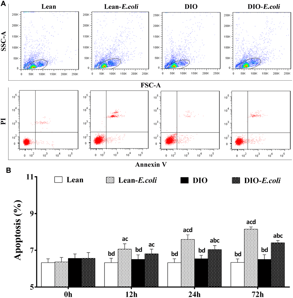 The percentages of hepatic apoptosis after E. coli infection. (A) The representative scatter gram of hepatic apoptosis at 72h after receiving intranasal instillations. (B) Hepatic apoptosis percentages. Note: Letter a, b, c or d represent difference (pE. coli group, DIO group, or DIO-E. coli group, respectively.