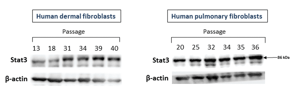 The levels of Stat3 proteins in primary cultures of human dermal (left panel) and pulmonary fibroblasts (right panel) of various passages. Immunoblots represent one of the 3 independent experiments.