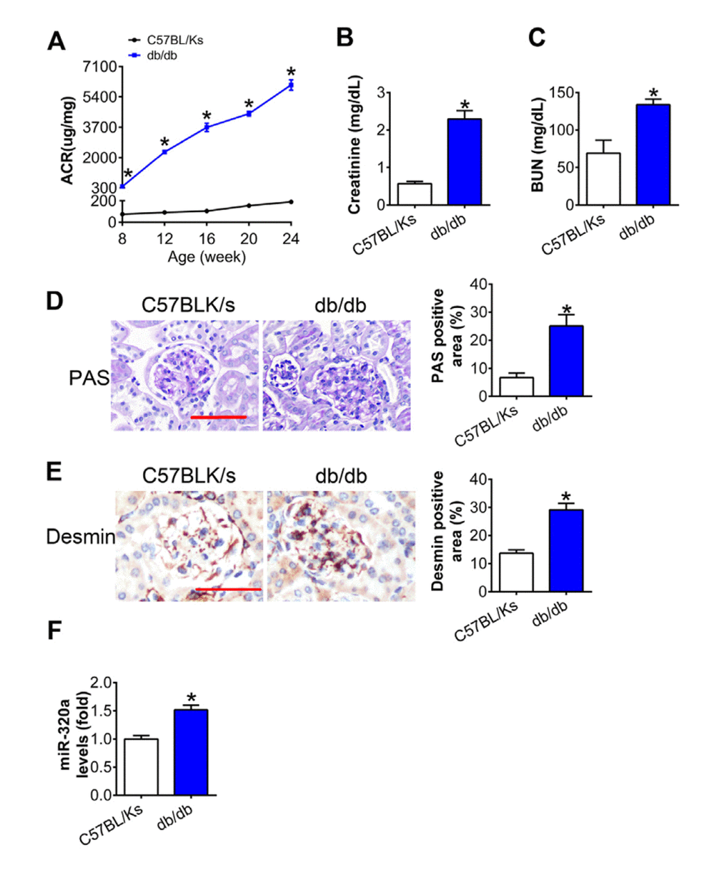 MiR-320a was increased in the kidney of diabetic mice. (A) Urinary ACR was determined every four weeks since the age of 8 weeks. (B) Serum creatinine and (C) BUN were detected at the age of 24 weeks. (D) Representative images of PAS staining of kidneys from C57BL/Ks and db/db mice. Scale bar, 50 μm. (E) Representative images of immunohistochemical staining of Desmin. Scale bar, 50 μm. (F) Relative miR-320a expression in renal cortex measured by real-time PCR. Data are expressed as mean ± SEM, n=8, *P