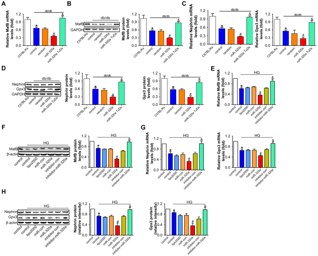 Overexpression of miR-320a down-regulated MafB in vitro and in vivo. Relative MafB (A) mRNA and (B) protein levels in differently treated db/db mice. Relative Nephrin and Gpx3 (C) mRNA and (D) protein expression in differently treated db/db mice. Data are expressed as mean ± SEM, n=8, *PE) mRNA and (F) protein levels in cultured podocyte cells. Relative Nephrin and Gpx3 expression measured by (G) real-time PCR and detected by (H) western blot. Data are expressed as mean ± SEM, n=3, *P