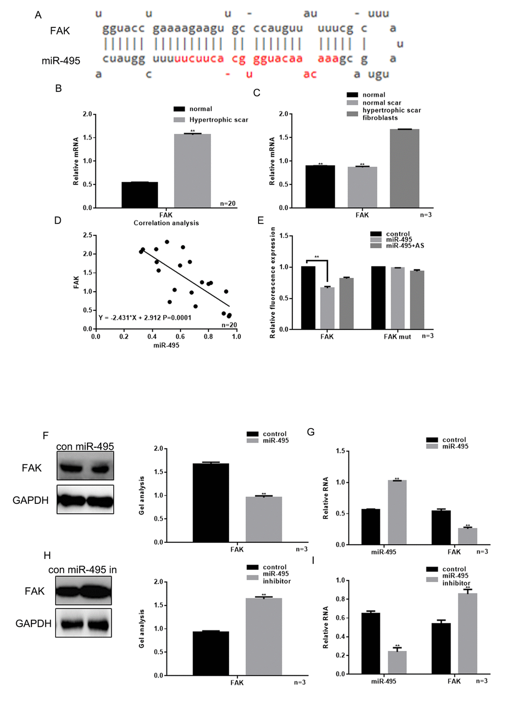 Relationship between miR-495 and FAK. (A) miRDB predicted that miR-495 specifically combined with FAK mRNA. (B) Expression of FAK in hypertrophic scar tissues and normal tissues were detected using real-time PCR. ** PC) Levels of FAK expression in hypertrophic scar fibroblasts, normal scar fibroblasts and normal fibroblasts were detected using real-time PCR. ** P## PD) Correlation between expression of miR-495 and FAK in hypertrophic scar. (E) Interaction between miR-495 and the FAK 3’-UTR was tested in luciferase reporter assays. Data are presented as the mean ± SEM. ** PF, G) Western blotting and real-time PCR showing that when miR-495 is overexpressed, FAK expression is downregulated. Data are presented as the mean ± SEM. ** P** P