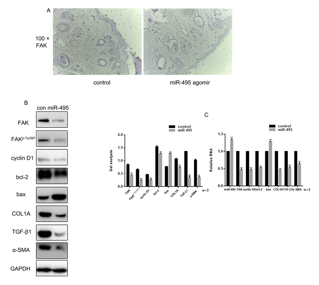 miR-495 inhibits FAK in vivo (A) Comparison of initial area, average healing time and scar area after healing in each group. (B) Immunohistochemical staining showing expression of FAK in the control and miR-495 agomir groups (magnification: 100×). (C, D) Expression of FAK, FAKp-Tyr397, cyclin D1, bcl-2, bax, COL1A, TGF-β1 and α-SMA were detected using western blotting and real-time PCR. Data are presented as the mean ± SEM. ** P