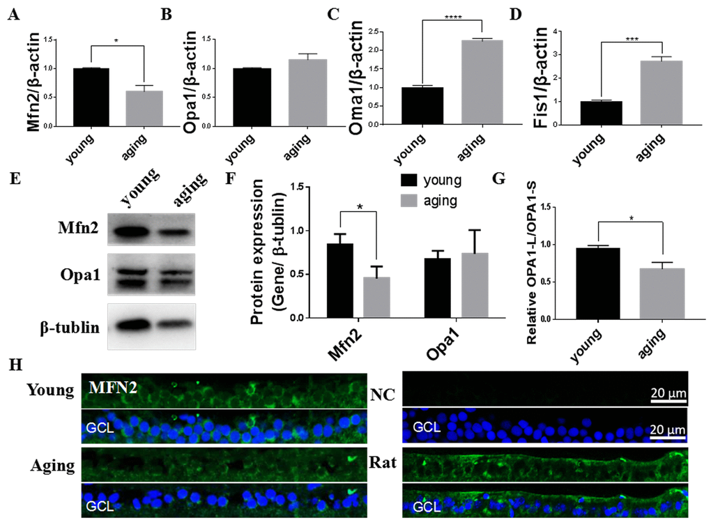 Mitochondrial fusion/fission imbalanced in aging zebrafish retinas. (A-D) Mfn2, Opa1, Oma1, and Fis1 expression in young and aging zebrafish retinas. Graphs represent (A) Mfn2, (B) Opa1, (C) Oma1, and (D) Fis1 gene expression by quantitative real-time PCR (mean ± SEM, *PE) Representative western blot showing the protein expression levels of Mfn2 and Opa1 in young and aging zebrafish retinas. (F) The graph depicts the densitometric mean and SEM normalized to the corresponding level of the loading control protein beta-tubulin (*PG) The ratio of Opa1-L/Opa1-S, as determined by densitometry of western blots as in E (*P. (H) Immunofluorescence localization and relative expression of Mfn2 in the RGC layer of young and aging zebrafish retina cross-sections. All photographs were taken at 40x magnification except rat sections were at 20x magnification. Young, 4-6 months old zebrafish; aging, 19-23 months old zebrafish; NC, negative control (no primary antibody); Rat, rat retina positive control; Opa1-L, Opa1 long segment; Opa1-S, Opa1 short segment; GCL, ganglion cell layer.