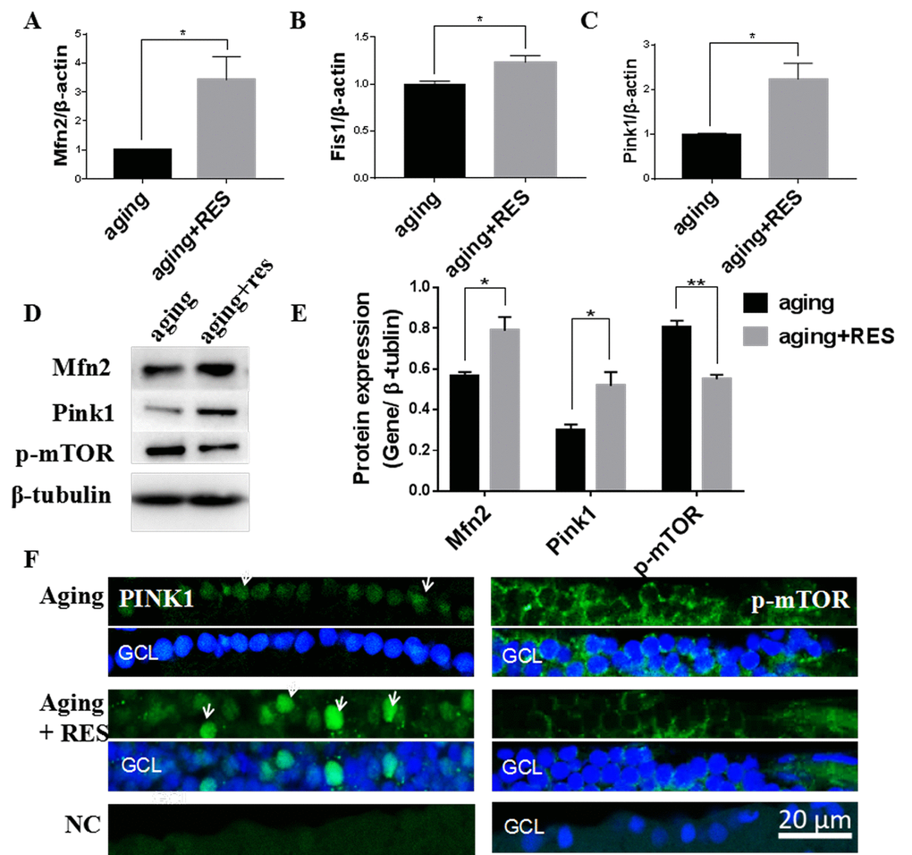 Resveratrol treatment activated Mfn2, Fis1, Pink1, and suppressed p-mTOR in aging zebrafish retina. (A-C) Mfn2, Fis1, Pink1 expression in aging and resveratrol-treated aging zebrafish retina. Graphs represent (A)Mfn2 (B) Fis1(C) Pink1 gene expression by quantitative real-time PCR (mean ± SEM, *PD)Representative western blot showing the protein expression levels of Mfn2,Pink1,p-mTOR in aging and resveratrol-treated aging zebrafish retina. (E)The graph showing the densitometric mean and SEM normalized to the corresponding level of the loading control protein beta-tubulin (*PF) Immunolocalization and relative quantitative expression of Pink1 and p-mTOR on RGC in aging and resveratrol-treated aging zebrafish retina cross-sections. Retina cross sections prepared from zebrafish eyes were immunostained with Mfn2 or p-mTOR antibody. Results present aging, resveratrol-treated aging, and negative control (without primary antibody). All photographs were taken at 40 times. aging, 19-23 months zebrafish; aging + RES, resveratrol-treated aging zebrafish for 10 days; NC, negative control; GCL, ganglion cell layer.