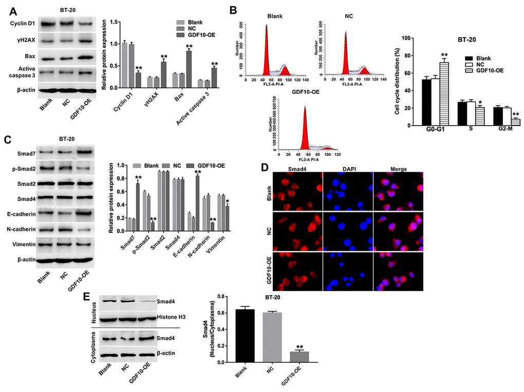 Overexpression of GDF10 induces cell cycle arrest and inhibits EMT in BT-20 cells. (A) The expression of cyclin D1, γH2AX, Bax, and active caspase-3 was investigated via western blotting in BT-20 cells transfected with GDF10 for 72 h. β-actin was used as internal control. Relative expression data were quantified by densitometry and normalized to β-actin. **P B) Cell cycle distribution in BT-20 cells transfected with GDF10 for 72 h. *P C) Smad7, p-Smad2, Smad2, Smad4, E-cadherin, N-cadherin, and Vimentin expression was assessed by western blotting in BT-20 cells transfected with GDF10 for 72 h. β-actin was used as internal control. Relative protein expression levels were quantified by densitometry and normalized to β-actin. *P D) Immunofluorescent assessment of the subcellular distribution of Smad4 in BT-20 cells transfected with GDF10. (E) Smad4 expression was assessed by western blotting in the nucleus and cytoplasma of BT-20 cells transfected with GDF10 for 72 h, respectively. Histone H3 and β-actin were used as internal control respectively. Magnification × 400.