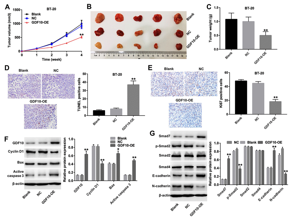 GDF10 expression inhibits BT-20 xenograft growth. (A) Tumor volumes were measured weekly post-inoculation of BT-20 cells infected with lentiviruses carrying the GDF10 gene or non-coding controls (NC). **P B) Photographs of BT-20 xenografts dissected 4 weeks after tumor cell inoculation. (C) Tumor weights. **P D) TUNEL staining of BT-20 tumors and quantification of TUNEL-positive cells. **P E) Ki67 IHC in excised BT-20 tumor sections and quantification of Ki67-positive cells. **P F) GDF10, cyclin D1, Bax, and active caspase-3 expression was assessed in tumor samples by western blotting. β-actin was used as internal control. Relative protein expression levels were quantified by densitometry and normalized to β-actin. *P G) The expression of Smad7, p-Smad2, Smad2, Smad4, E-cadherin, and N-cadherin was investigated by western blotting in excised tumor samples. β-actin was used as internal control. Relative protein expression levels were quantified by densitometry and normalized to β-actin. *P 