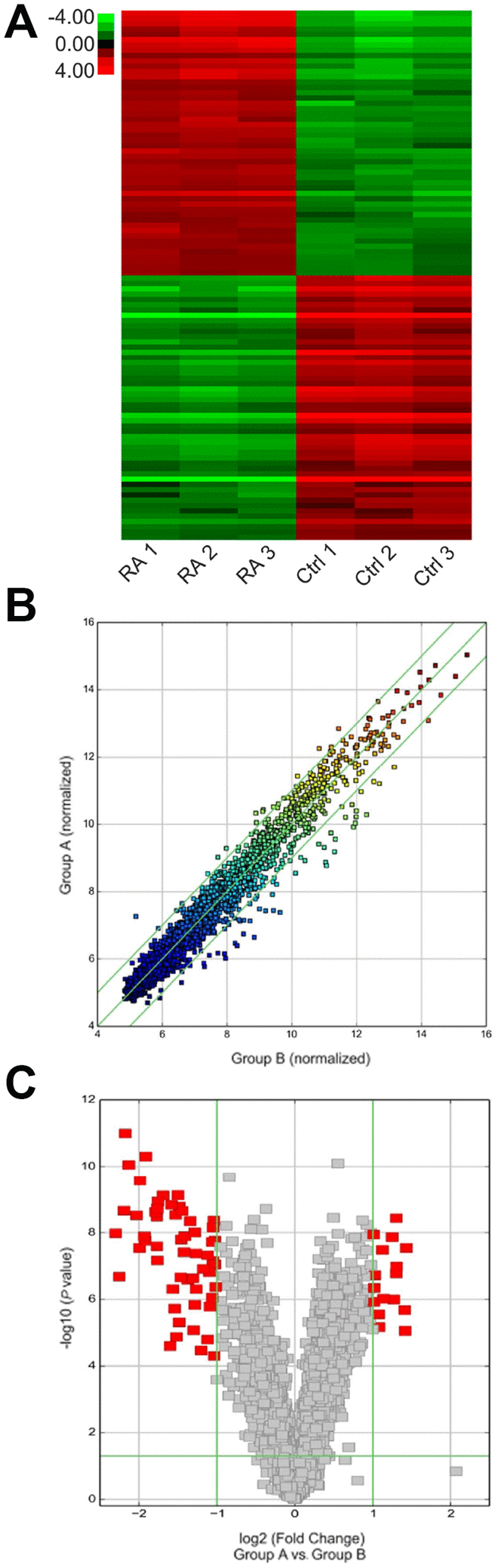 Expression of various circRNAs in the cartilage tissue of RA patients. (A) Hierarchical clustering assessment of circRNAs that displayed variation in expression patterns between control and RA groups; every group comprised three individuals (over two-fold difference in expression; P B) Scatter plot was used to evaluate alterations in circRNA expression between control (group A) and RA (group B) specimens. Values corresponding to X and Y axes in the scatter plot were normalized signal values of specimens (log2 scaled). Green lines indicate fold alterations. CircRNAs over the top green line and below the bottom green line indicate over two-fold changes. (C) Volcano plots were built to show fold change values and P values. The vertical lines show two-fold upregulation and downregulation between control and RA specimens (A versus B), and the horizontal line shows P value. The red point in the plot shows various expression patterns of circRNAs with statistical significance.