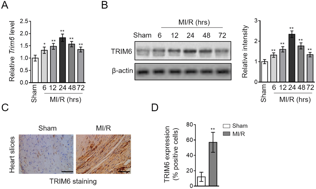 TRIM6 expression is induced in the heart after MI/R injury. (A–D) Mice were subjected to sham surgery or experimental MI/R. Each group contained 7 mice. At different time periods after reperfusion, the hearts were harvested for analyses. (A) The mRNA level of Trim6 in the heart was determined by qRT-PCR analysis. Actb was used as an endogenous control. Results relative to sham are shown. (B) The protein level of TRIM6 in the heart was determined by Western blotting analysis. β-Actin was used a loading control. The representative images (left) and band intensity relative to sham (right) are shown. (C) The expression of TRIM6 in the heart slices at 24 hrs after reperfusion was detected by immunohistochemistry (IHC). Scale bar, 100 μM. (D) The quantification of TRIM6 staining shown in (C) was shown as percentage of positive staining cardiomyocytes in the heart slices. Data are expressed as mean ± SD (n = 7). **, P 