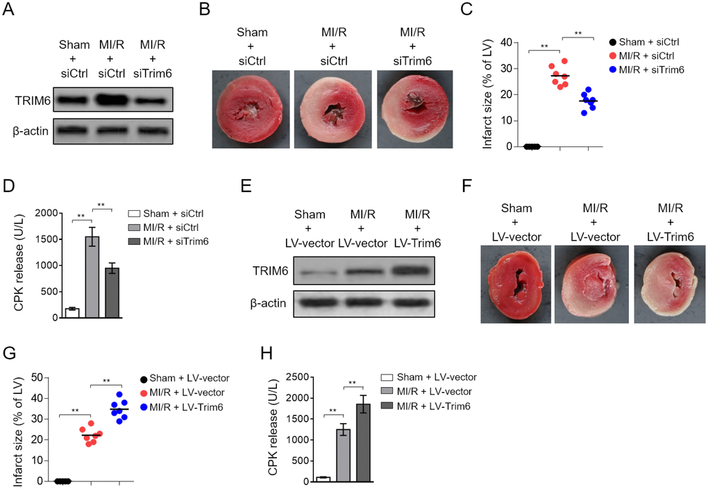 Cardiac TRIM6 promotes MI/R injury. (A–D) The mouse heart was pre-transfected in vivo with control siRNA (siCtrl) or siRNA targeting Trim6 (siTrim6) 48 hrs before surgery. Mice were then subjected to sham surgery or experimental MI/R. Each group contained 7 mice. At 24 hrs after reperfusion, the heart and serum samples were harvested for analyses. (A) The protein level of TRIM6 in the heart was determined by Western blotting analysis. β-Actin was used a loading control. (B) The mid-myocardial cross sections of hearts were stained with TTC to show infarct size (IS). The representative images are shown. (C) The infarct severity in each group shown as in (B) is expressed as % of LV (IS/LV). (D) The level of serum creatine phosphokinase (CPK) from each group was measured (U/L). (E–H) The mouse heart was pre-infected in vivo with lentivirus expressing vector control (LV-vector) or Trim6 (LV-Trim6) 48 hrs before surgery. Mice were then subjected to sham surgery or experimental MI/R. Each group contained 7 mice. At 24 hrs after reperfusion, the heart and serum samples were harvested for analyses. (E) The protein level of TRIM6 in the heart was determined by Western blotting analysis. β-Actin was used a loading control. (F) The mid-myocardial cross sections of heart were stained with TTC. The representative images are shown. (G) The quantification of IS in each group (% of LV). (H) The level of serum creatine phosphokinase (CPK) from each group was measured (U/L). All data are expressed as mean ± SD (n = 7). **, P 