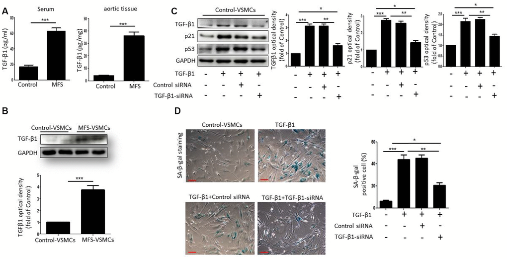 TGF-β1 induces cellular senescence in VSMCs. (A) TGF-β1 concentrations in serum from control donors and MFS patients was measured using an ELISA. n=6. (B) Western blotting and quantitative analysis of TGF-β1 levels in control- and MFS-VSMCs. n=3. (C) Western blotting and quantitative analysis of TGF-β1, p53 and p21 levels in control-VSMCs left untreated or treated with TGF-β1 or TGF-β1 combined with control-siRNA or TGF-β1-siRNA. n=3. (D) Representative images and quantitative analysis of SA-β-gal staining in control-VSMCs left untreated or treated with TGF-β1 or TGF-β1 combined with control-siRNA or TGF-β1-siRNA. n=3. Numbers of SA-β-gal-positive cells are expressed as percentages of the total cells. Data are expressed as the mean±SEM. *p