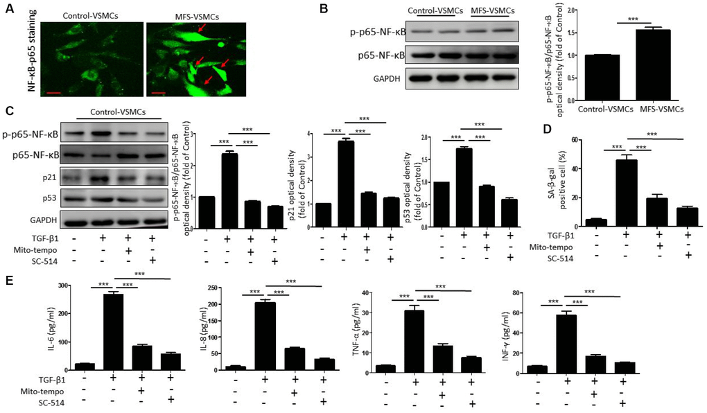 TGF-β1 induces cellular senescence in VSMCs through activation of ROS/NF-κB signaling. (A) Representative images of p65-NF-κB staining in control- and MFS-VSMCs. Scale bar=50 μm. (B) Western blotting and quantitative analysis of p-p65-NF-κB and p65-NF-κB levels in control- and MFS-VSMCs. (C) Western blotting and quantitative analysis of p-p65-NF-κB, p65-NF-κB, p53 and p21 levels in control-VSMCs treated with TGF-β1, TGF-β1+Mito-tempo or TGF-β1+SC-154. (D) Quantitative analysis of SA-β-gal staining in control-VSMCs treated with TGF-β1, TGF-β1+Mito-tempo or TGF-β1+SC-154. (E) Concentrations of IL-6, IL-8, TNF-α and INF-γ in medium conditioned by control-VSMCs treated with TGF-β1, TGF-β1+Mito-tempo or TGF-β1+SC-154. Data are expressed as the mean±SEM. n=3. ***p