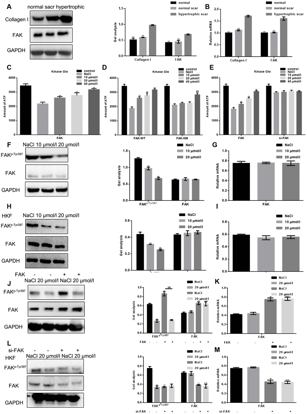 Apigenin suppresses the kinase activity of FAK and inhibits FAK phosphorylation. (A, B) Western blot and real-time PCR analyses showing the Collagen I and FAK content in normal skin tissue, normal scar tissue and hypertrophic scar tissue. ** P C) Kinase Glo luminescence assays showing the inhibitory effect of apigenin on the kinase activity of FAK; 2 μM ALX was used as an activated control. Data are shown as the mean ± SD. ** P D) Kinase Glo luminescence assays comparing the inhibitory effects of apigenin on the kinase activities of FAK-WT and FAK-KM(Y397A); 2 μmol ALX used as an activated control. Data are shown as the mean ± SD. ** P P E) Kinase Glo luminescence assays examining the inhibitory effects of apigenin on the kinase activities of FAK in HSFs transfected with si-FAK; 2 μmol ALX used as an activated control. Data are shown as the mean ± SD. ** P F–I) Western blot and real-time PCR analyses of FAKp-Tyr397 and FAK levels in HSFs and HKFs treated for 24 h with NaCl or the indicated concentration of apigenin. **P J, K) Western blot and real-time PCR analyses of the effect of 20 μM apigenin FAKp-Tyr397 and FAK levels in HSFs overexpressing empty vector or FAK. **P P L, M) Western blot and real-time PCR analyses of the effect of 20 μM apigenin on FAKp-Tyr397 and FAK levels in HSFs transfected with si-FAK or si-NC (negative control). **P 