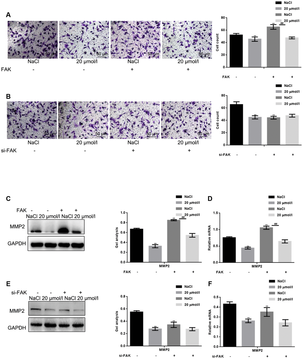 Apigenin inhibits HSF migration by suppressing FAK phosphorylation. (A) Transwell assays (without Matrigel) with HSFs overexpressing vector or FAK and treated with 20 μM apigenin,. **P P B) Transwell assays (without Matrigel) with HSFs transfected with si-FAK or si-NC (negative control) and treated with 20 μM apigenin. **P C, D) HSFs overexpressing vector or FAK were treated with 20 μM apigenin, after which western blot and real-time PCR assays were performed to detect levels of MMP2 expression. **P P E, F) HSFs transfected with si-FAK or si-NC (negative control) were treated with 20 μM apigenin, after which western blot and real-time PCR assays were performed to detect levels of MMP2expression. **P 