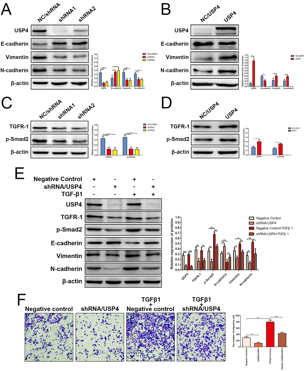 USP4 activated TGF-β signaling pathway to induce epithelial-to-mesenchymal transition (EMT). (A) The expression of EMT markers in SK-Hep1- shRNA/USP4 cells and in negative control cells (* P B) The expression of EMT markers in HuH7-USP4 cells and in negative control cells (* P C) The expression of TGFR-1 and p-Smad2 in SK-Hep1- shRNA/USP4 cells and in negative control cells (*** P D) The expression of TGFR-1 and p-Smad2 in HuH7-USP4 cells and in negative control cells (* P E) The expression of TGFR-1, p-Smad2 and EMT markers in SK-Hep1- shRNA/USP4 cells or in negative control cells, with TGF-β1(10ng/mL)treatment for 24h or without (* P F) The migration ability of SK-Hep1-shRNA/USP4 cells or negative control cells, with TGF-β1 treatment or without, detected by Transwell migration assay (** P 