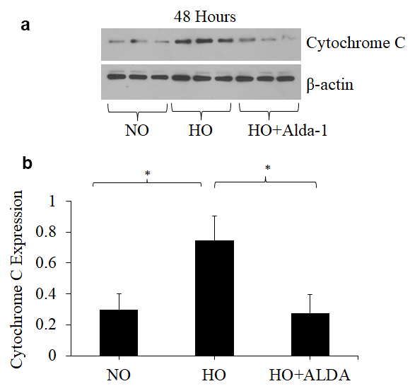 Activation of ALDH2 attenuates hyperoxia-induced increase in cytochrome c expression in lung vascular endothelial cells. (a) Whole cell lysates extracted from HMVEC cultured under different conditions (normoxia, 48 hrs of hyperoxia, or Alda-1 pretreatment followed by 48 hrs of hyperoxia) were evaluated for cytochrome C levels by Western blotting. Equal amounts of protein (20µg) were loaded per each lane. (b) Expression of Cytochrome C was normalized to β-actin and presented in arbitrary units. The results are shown in mean ± SEM (n=3). Data presented are representative of two independent experiments.
