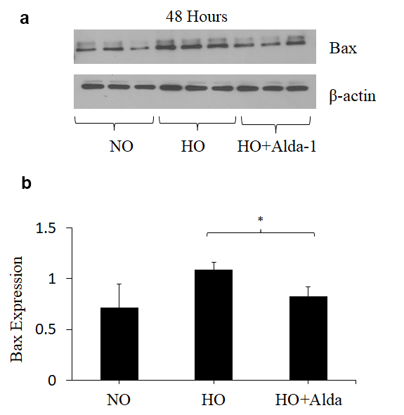 ALDH2 activation via Alda-1 attenuates hyperoxia-induced increase in Bax expression in lung vascular endothelial cells. (a) Whole cell lysates extracted from HMVEC cultured under different conditions (normoxia, 48 hrs of hyperoxia, or Alda-1 pretreatment followed by 48 hrs of hyperoxia) were evaluated for Bax levels by Western blotting. Equal amounts of protein (20µg) were loaded per each lane. (b) Expression of Bax was normalized to β-actin and presented in arbitrary units. The results are shown in mean ± SEM (n=3). Data presented are representative of two independent experiments.