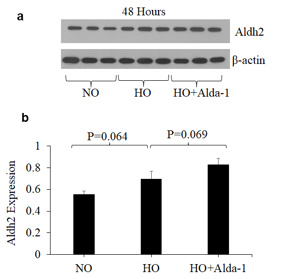 ALDH2 activation through Alda-1 pretreatment enhances ALDH2 expression in lung vascular endothelial cells under hyperoxia. (a) Whole cell lysates extracted from HMVEC cultured under different conditions (normoxia, 48 hrs of hyperoxia, or Alda-1 pretreatment followed by 48 hrs of hyperoxia) were evaluated for ALDH2 levels by Western blotting. Equal amounts of protein (20µg) were loaded per each lane. (b) Expression of ALDH2 was normalized to β-actin and presented in arbitrary units. The results are shown in mean ± SEM (n=3). Data presented are representative of three independent experiments.