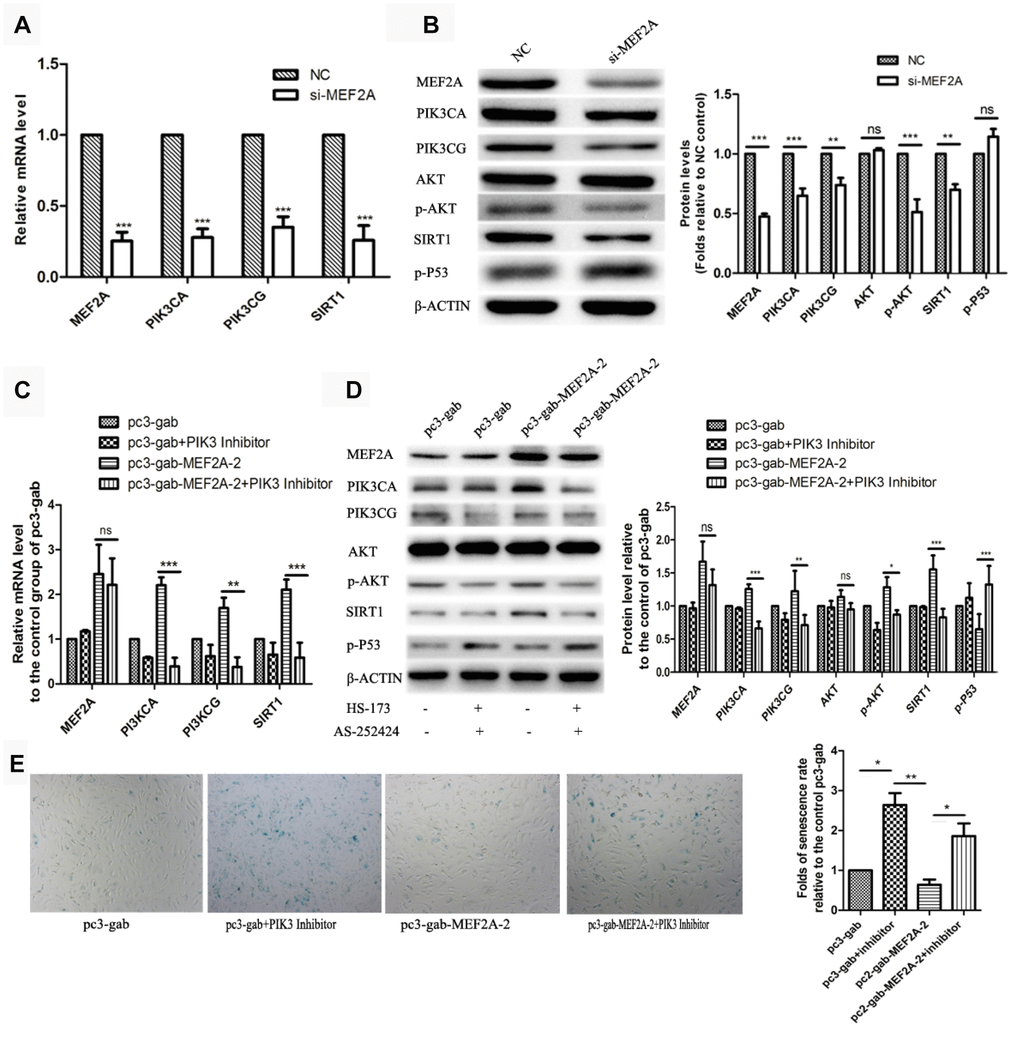 The influence of changes in expression of MEF2A on downstream gene expression. (A) Changes in downstream gene mRNA levels after transfection of si-MEF2A in HUVEC; (B) Changes in downstream gene protein levels after transfection of si-MEF2A in HUVEC; (C) Effect of transfection of MEF2A overexpression plasmid or transfection of MEF2A overexpression plasmid plus PI3K inhibitor on the mRNA level of downstream gene in HUVEC; (D) Influence of transfection of MEF2A overexpression plasmid or transfection of MEF2A overexpression plasmid plus PI3K inhibitors on downstream gene protein levels in HUVEC. (E) Impact of transfection of MEF2A overexpression plasmid or transfection of MEF2A overexpression plasmid plus PI3K inhibitor on HUVEC phenotype. The mRNA level, protein level and senescence rate were expressed as the mean fold changes relative to the control group, and the error bars represent the standard error of the fold changes in 3 independent experiments. *, P P P 