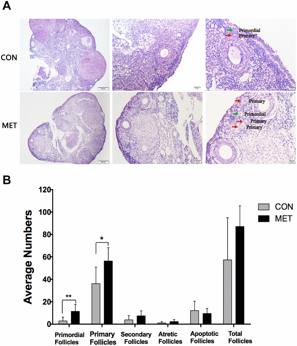 Effect of MET feeding for 6 months on follicle numbers at different stages. (A), The histological images of the ovaries in the CON and MET groups. The green and red arrows show primordial and primary follicles respectively. (B). The average number of follicles in each stage in the two groups. Data were presented as the mean± S.E.M. *indicates a significant difference from the CON group. *P