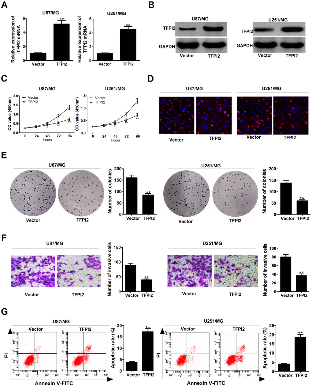 TFPI2 up-regulation represses proliferation and invasion, and enhanced apoptosis in GBM cells. (A and B) TFPI2 mRNA and protein levels were evaluated in U87/MG and U251/MG cells after transfection with empty vector or pcDNA-TFPI2. (C and D) CCK-8 and EdU staining assays were performed to examine the effects of TFPI2 overexpression on U87/MG and U251/MG cell proliferation. (E) Colony forming assay was conducted to detect the cloning ability in Vector- or pcDNA-TFPI2-transfected U87/MG and U251/MG cells. (F) Transwell assay of invasive ability in U87/MG and U251/MG cells following TFPI2 up-regulation. (G) Flow cytometry analysis of apoptotic rate in U87/MG and U251/MG cells introduced with empty vector or pcDNA-TFPI2. *P **P 