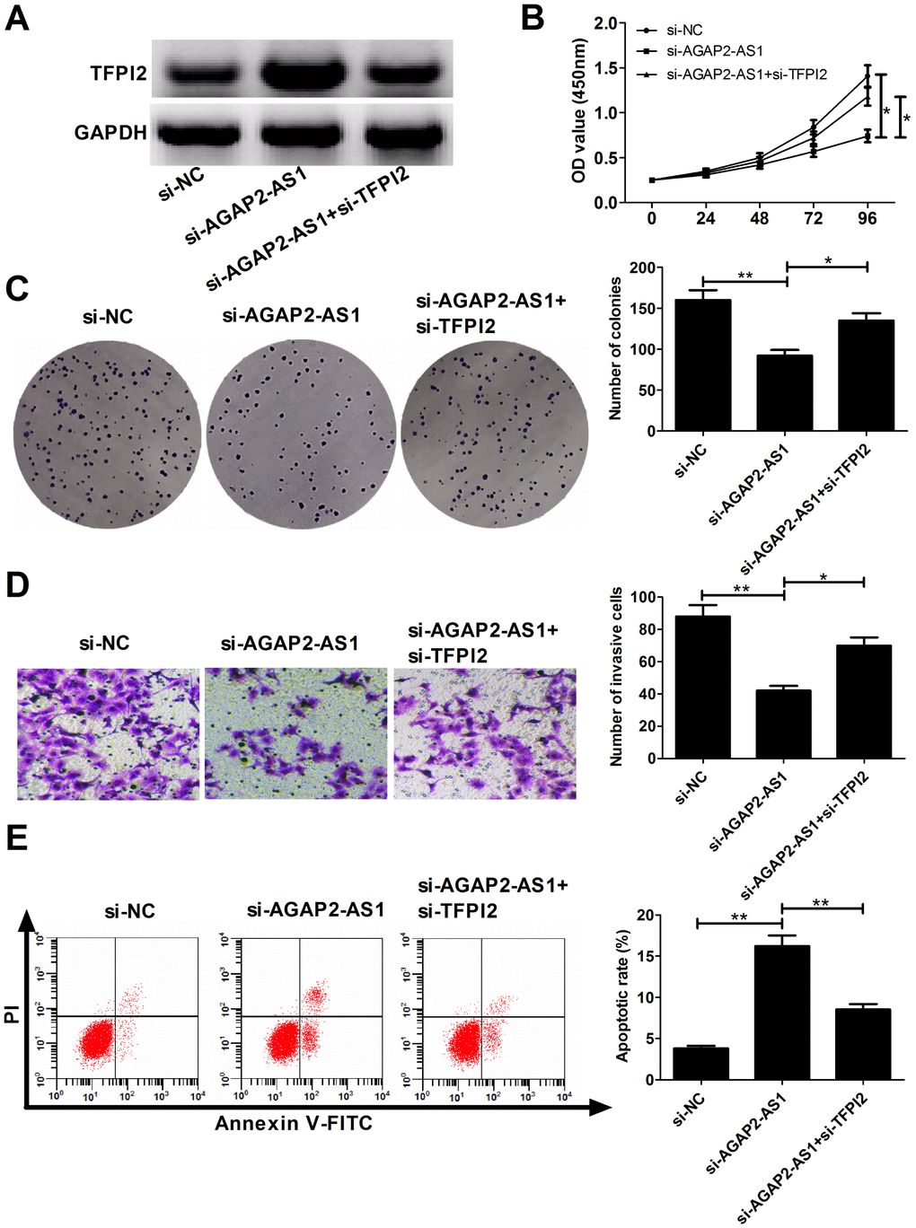 AGAP2-AS1 promotes GBM progression partially through epigenetically inhibiting TFPI2 expression in vitro. U87/MG cells were transfected with si-NC, si-AGAP2-AS1, or co-transfected with si-AGAP2-AS1 and si-TFPI2. (A) Western blot analysis of TFPI2 protein level in transfected cells. (B) CCK-8 assay of proliferation ability in transfected cells. (C) Colony formation assay of cloning ability in transfected cells. (D) Transwell assay of invasiveness in transfected cells. (E) Flow cytometry analysis of apoptosis in transfected cells. *P **P 
