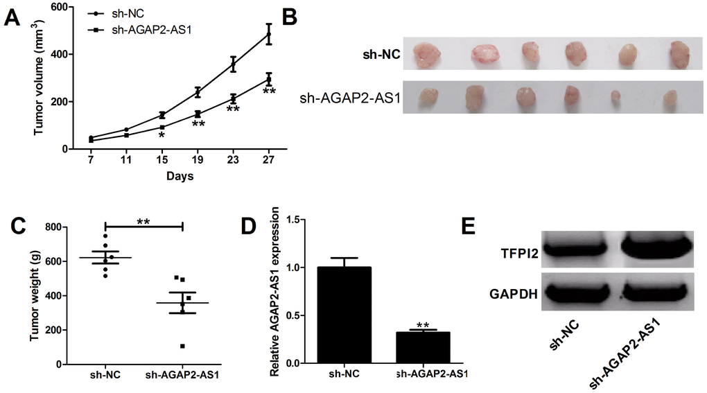 Silencing of AGAP2-AS1 suppresses GBM growth in vivo. U87/MG cells stably transfected with sh-NC or sh-AGAP2-AS1 were inoculated into nude mice (n=6). (A) Tumor volumes were monitored from the seventh day after cell injection. (B and C) At day 27 after cell inoculation, the tumors were removed, photographed and weighed. (D) qRT-PCR analysis of AGAP2-AS1 expression in tumors. (E) Western blot analysis of TFPI2 expression in tumors. *P **P 