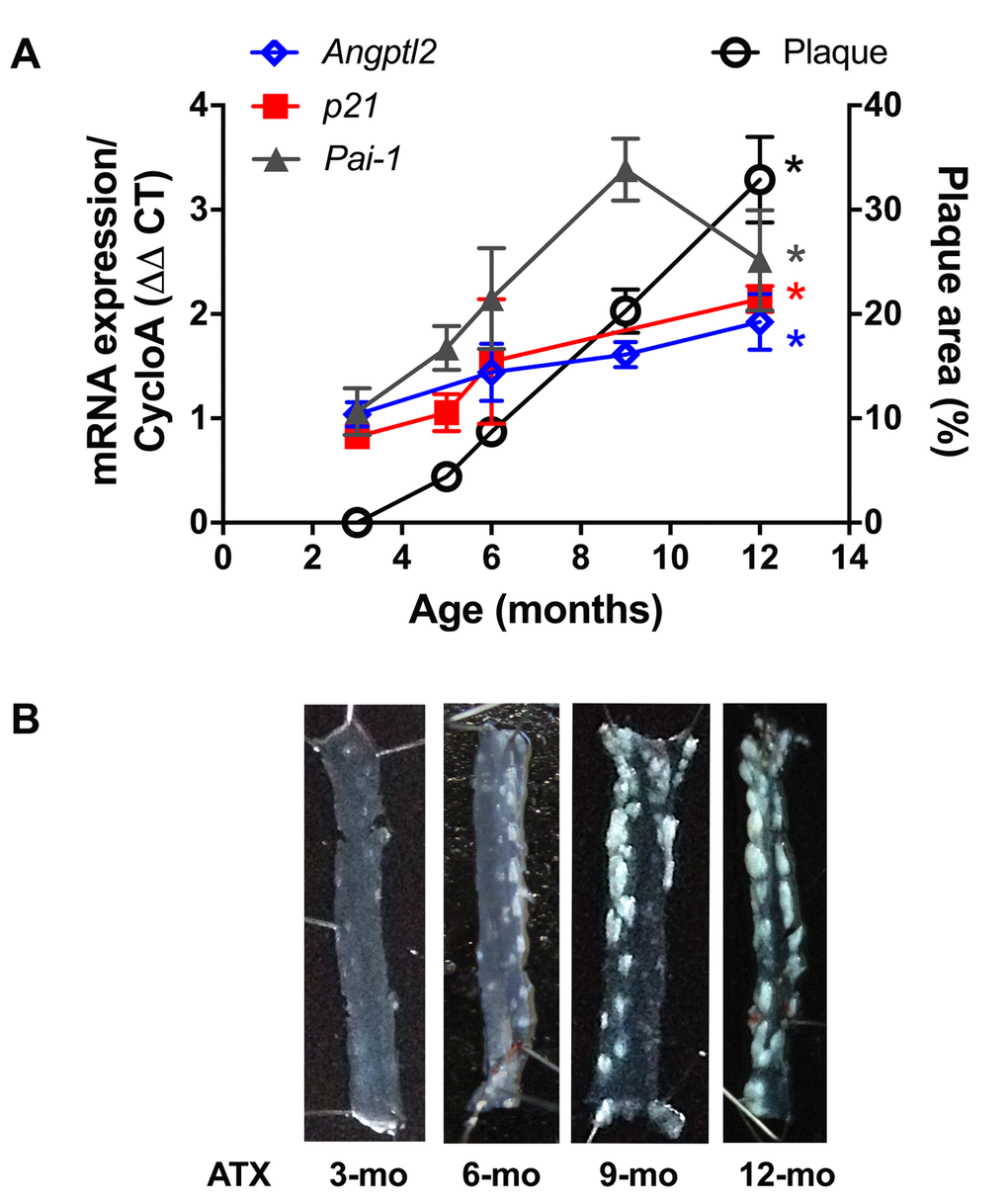 Age-dependent increase of senescence-associated p21, Pai-1 and angptl2 expressions in the native endothelium parallels plaque growth in the aorta. (A) mRNA expression of indicated genes was quantified in the native aortic endothelium of 3-mo (n=4), 5-mo (n=4), 6-mo (n=4) and 12-mo (n=4) control ATX mice. The average level of gene expression in 3-mo ATX mice was arbitrarily set at 1. Plaque area was quantified from longitudinally open thoracic aortas of 3-mo (n=7), 5-mo (n=5), 6-mo (n=7), 9-mo (n=12) and 12-mo (n=4) ATX mice. Data are expressed as mean±SEM. *: pvs. 3-mo ATX mice. (B) Representative pictures of age-related increase in atherosclerotic plaque in 3-, 6-, 9- and 12-mo ATX mice.