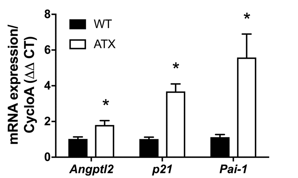 Increased expression of senescence-associated p21, Pai-1 and angptl2 in the native aortic endothelium of 6-month old ATX compared to WT mice. mRNA expression of indicated genes was quantified in the native aortic endothelium of 6-mo WT and ATX mice (n=3). The average level of gene expression in 6-mo WT mice was arbitrarily set at 1. Data are expressed as mean±SEM. *: pvs. WT mice.